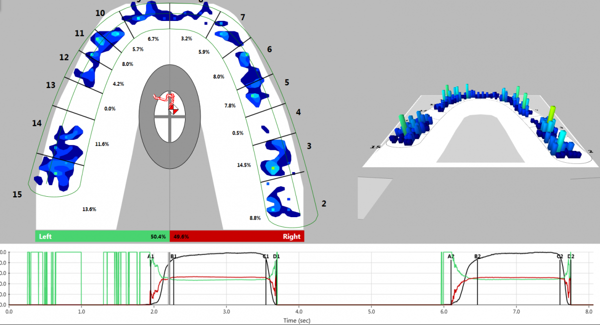 Dental Occlusion Measured with TScan Tekscan